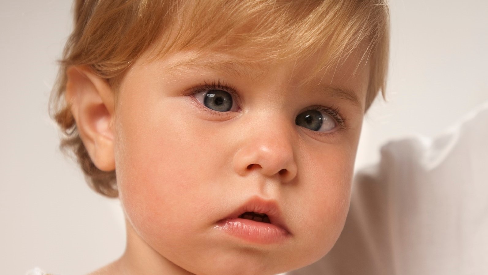 CLOSE UP portrait of adorable little girl with Amblyopia illness.
